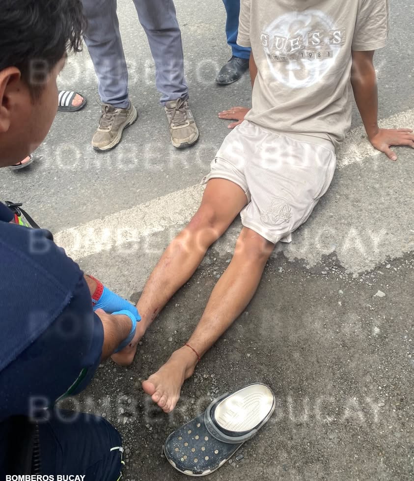 Accidente en Av. Paquisha deja fractura de tibia tras colisión frontal